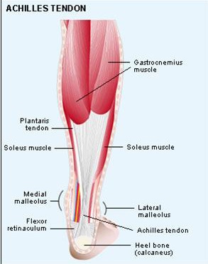 Calcaneal tendinopathy hot sale